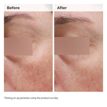 5% Face and Body Emulsion - Root Reset