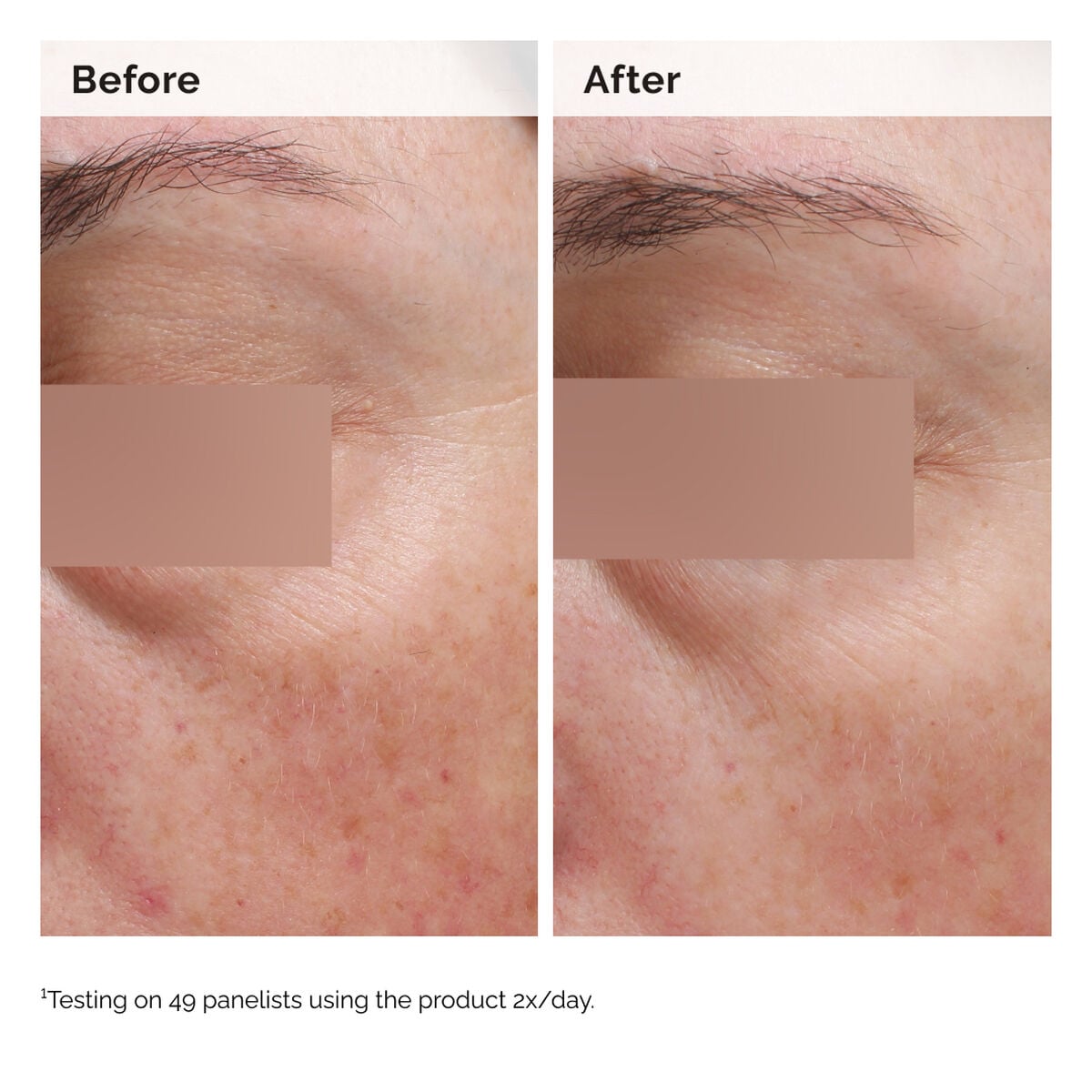 5% Face and Body Emulsion - Root Reset