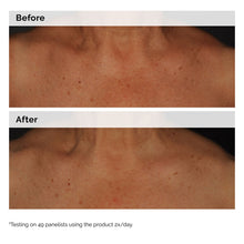 5% Face and Body Emulsion - Root Reset