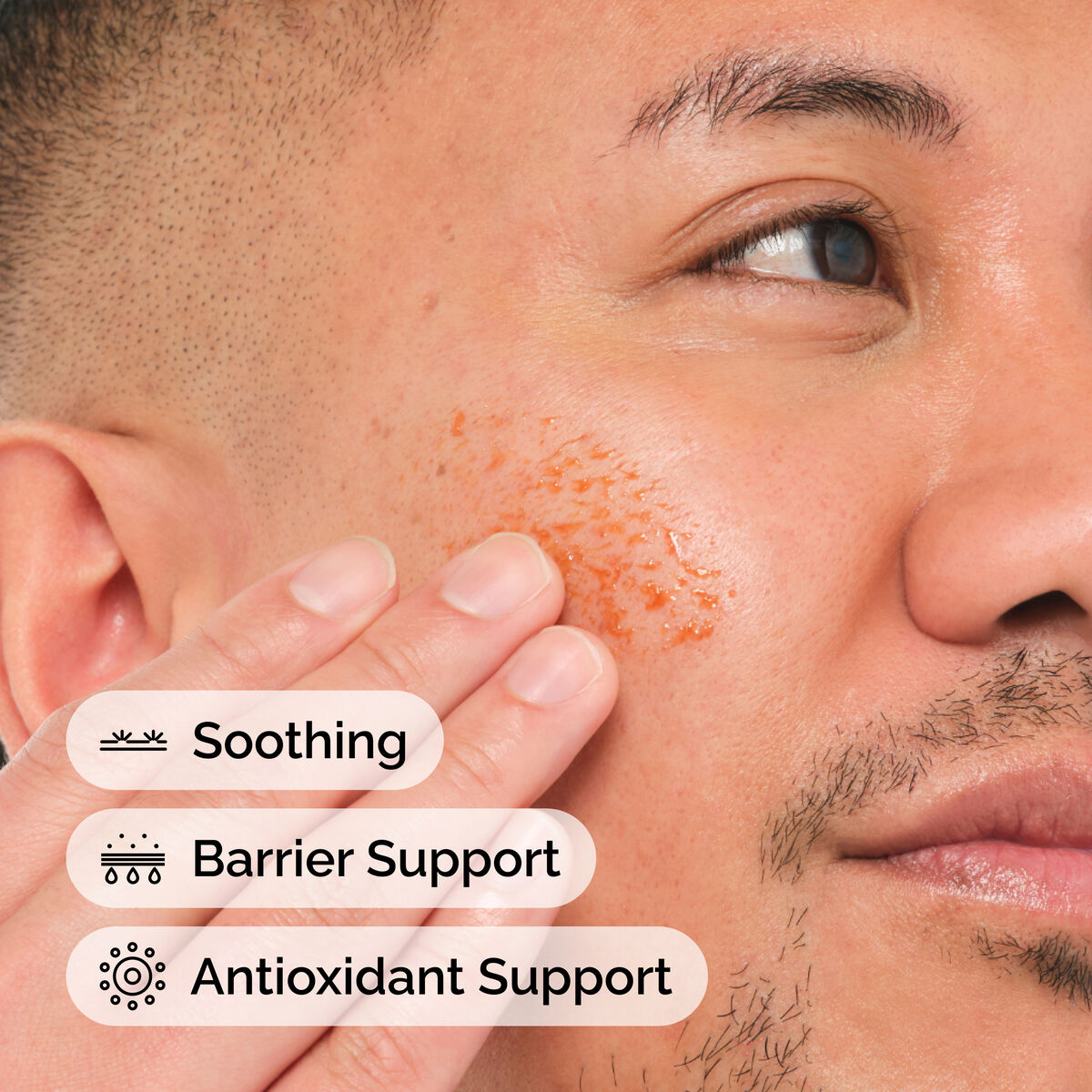 5% - Skin Support