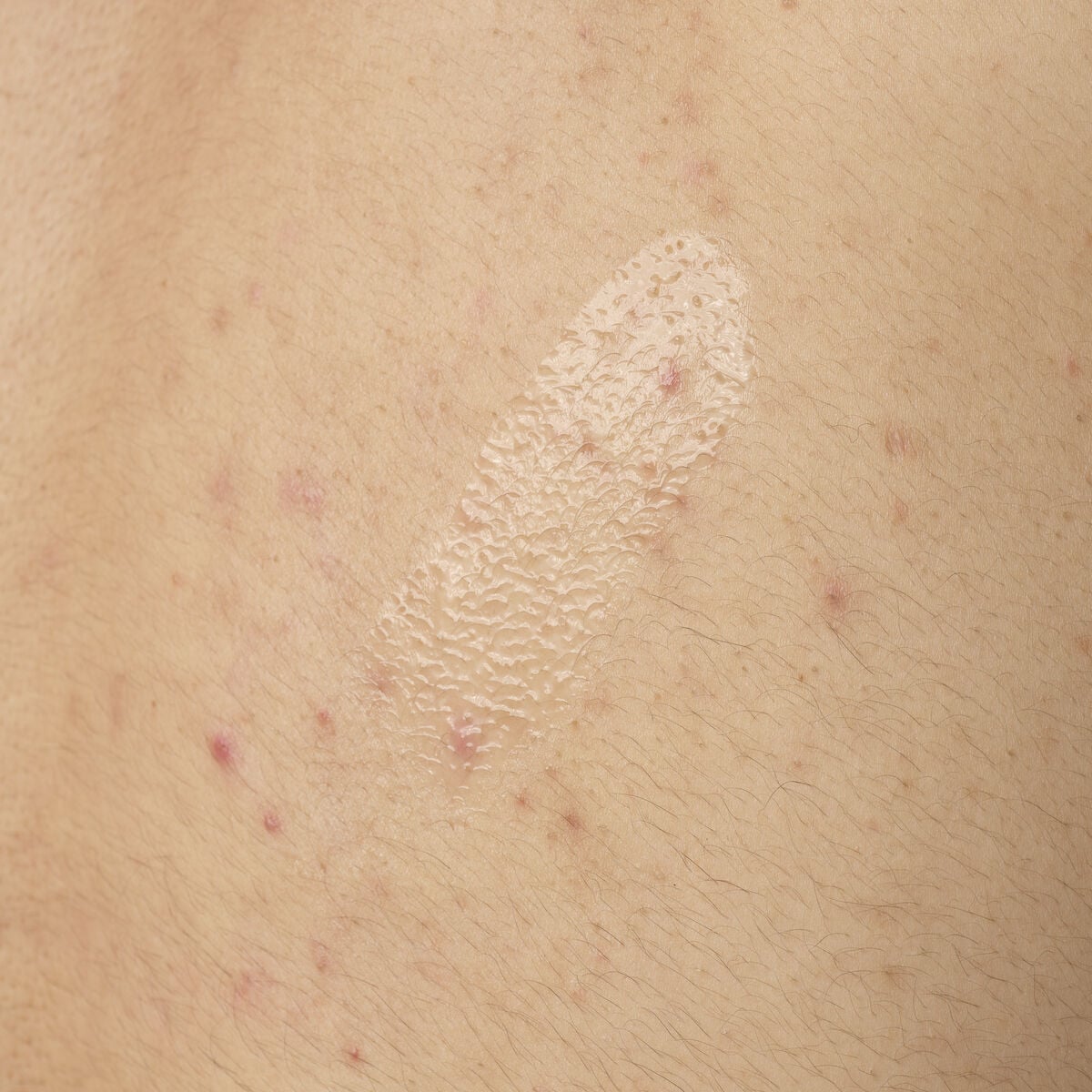 Acid 0.5% Body Serum - Everyday Pop