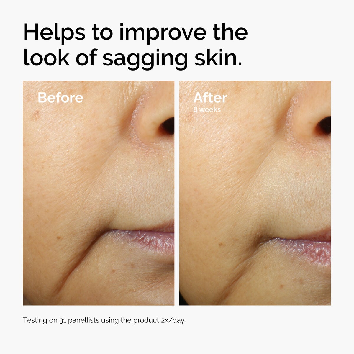 3% + Escin 1% Face Serum - Bright Finish
