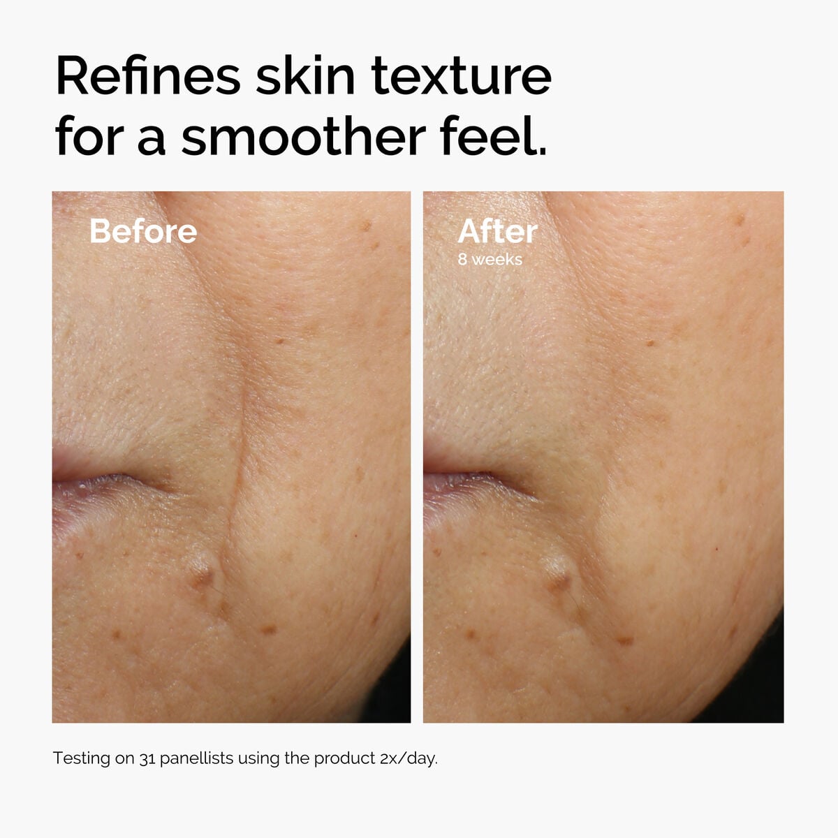 3% + Escin 1% Face Serum - Bright Finish