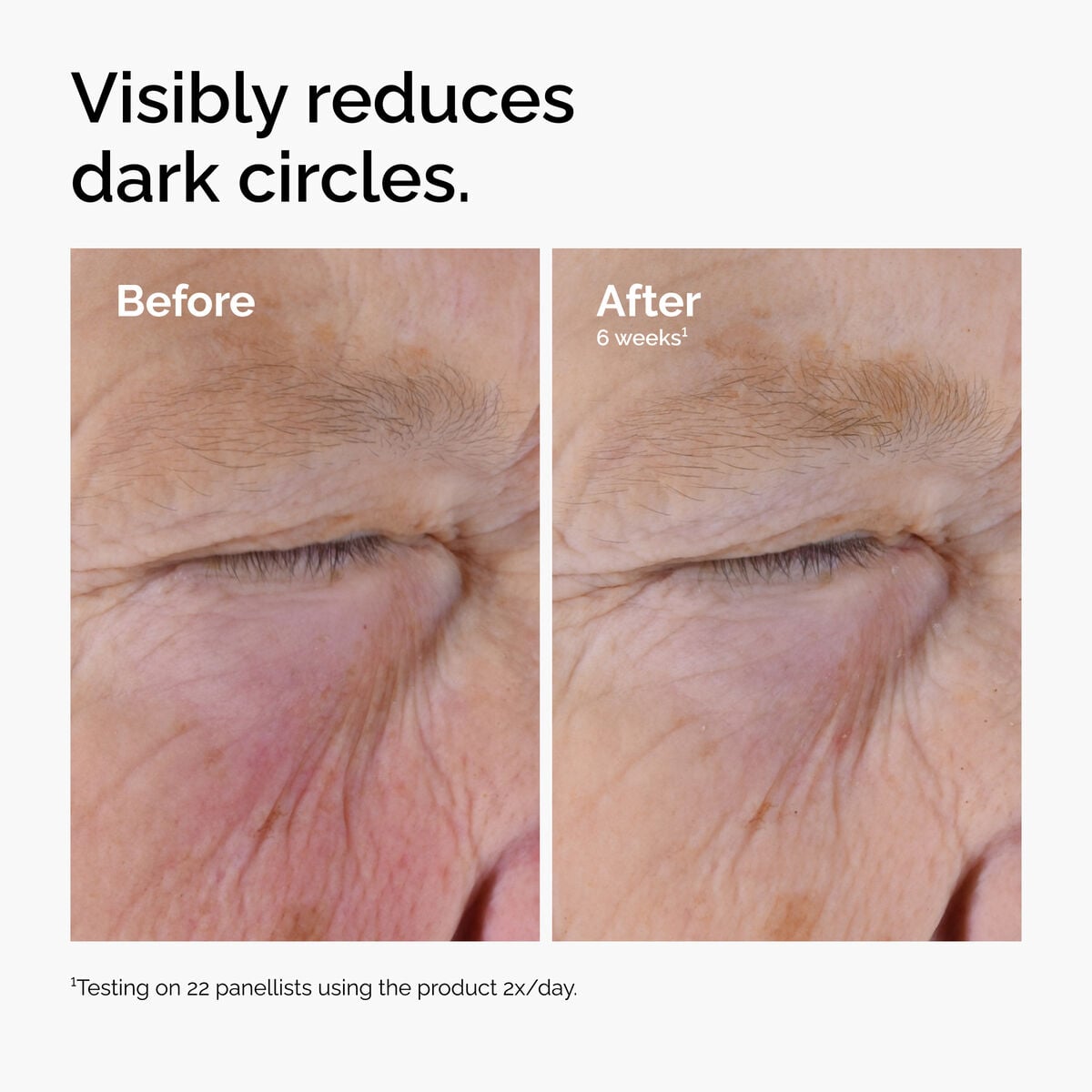 5% + EGCG Eye Serum - Gift Ready