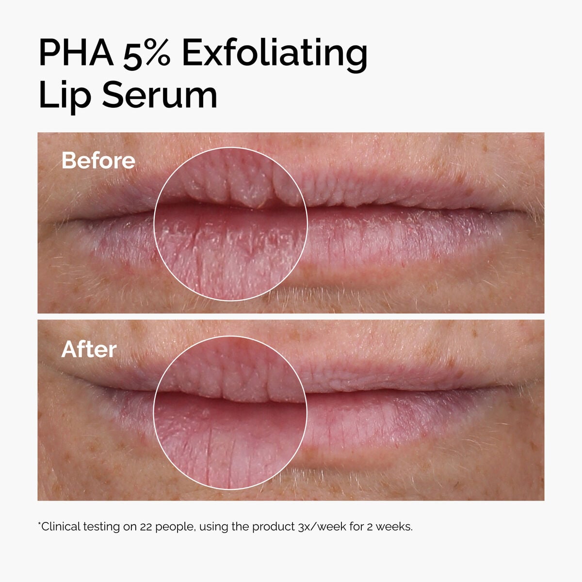 PHA 5% Exfoliating Lip Serum - Ready Look